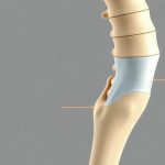¿Sabías que es un osteofito?